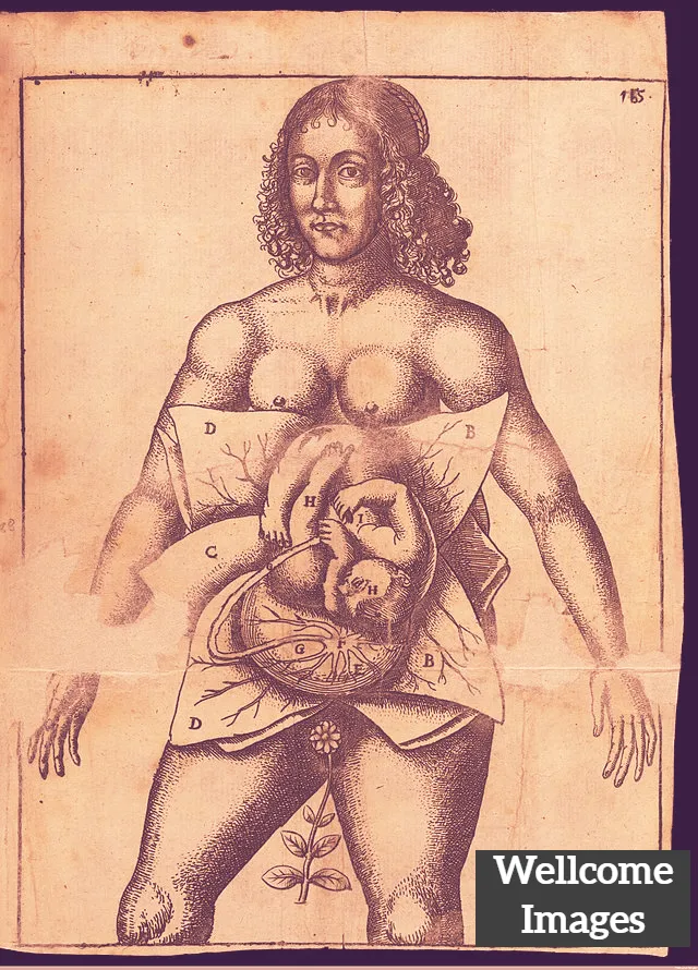 A 17th-century anatomical illustration showing a fetus in the womb. (Credit: Wellcome Collection)