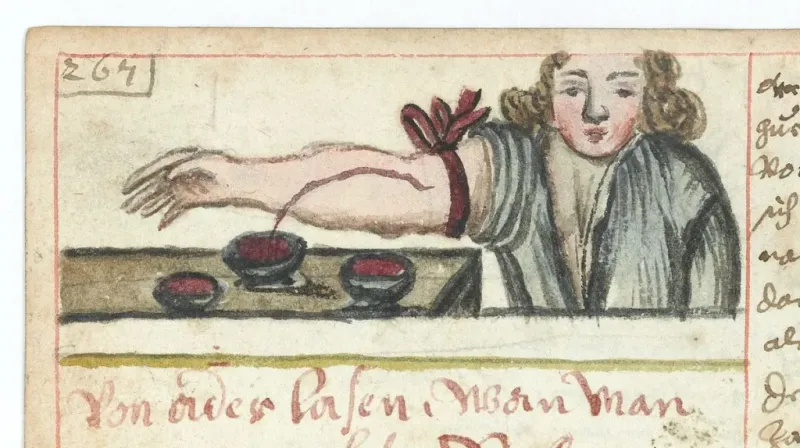 Bloodletting