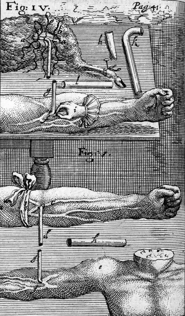 A detailed illustration of early blood transfusion techniques used in the 17th century, showcasing the setup for transferring blood between animals and humans.